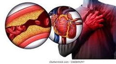 Heart Health, Clear your Artries