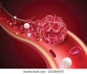 Heart Health, Clear your Artries